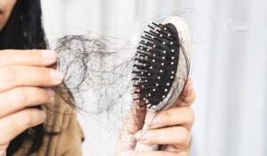 Queda de cabelo depois de emagrecer: por que acontece?